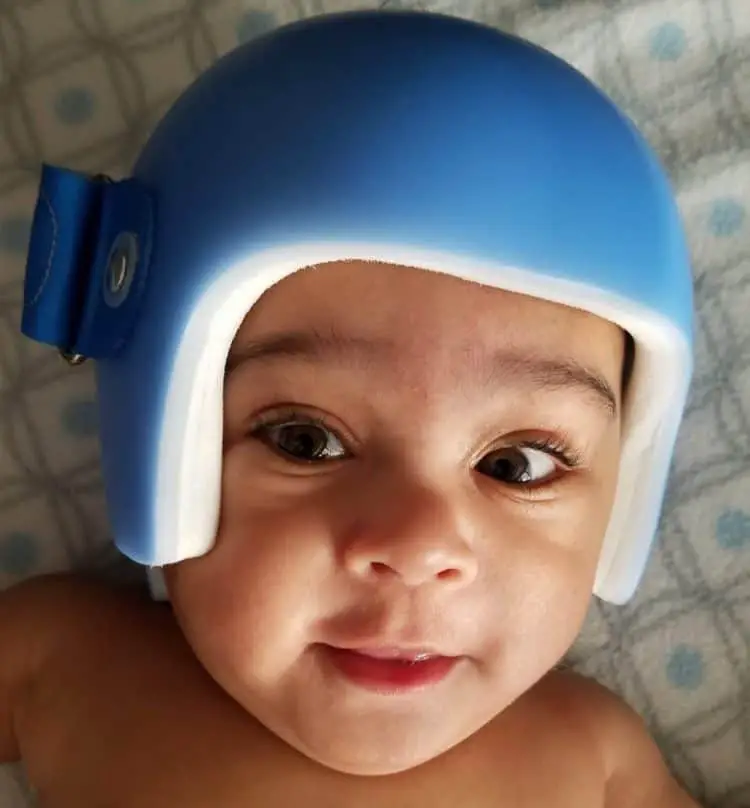 Baby Wearing Helmet